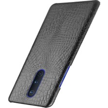 Colorful Shop Oneplus 8 Için Şık Klasik Kılıf Klasik Timsah Moda Anti Scratch (Yurt Dışından)