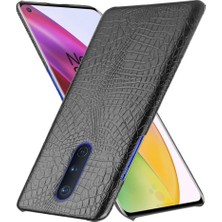 Colorful Shop Oneplus 8 Için Şık Klasik Kılıf Klasik Timsah Moda Anti Scratch (Yurt Dışından)