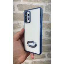 Vip Case Samsung A72 Logo Detaylı Kenarları Renkli Kamera Korumalı Luxury Megavip Kılıf