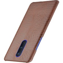 YH Market Oneplus 8 Için Şık Klasik Kılıf Klasik Timsah Moda Anti Scratch (Yurt Dışından)