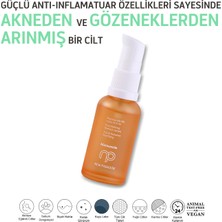 New Paradise Akne ve Leke Karşıtı Yoğun Işıltılı Niacinamide Serum 30 ml