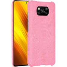 SZY Mall Şık Klasik Durumda Xiaomi Poco X3 Nfc Klasik Timsah Moda Anti (Yurt Dışından)