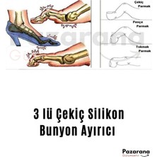 Butik Silikon Çekiç Parmak Ayırıcı Şekil Bozukluk Giderici Yastık Çekiç Desteği Parmak Ayırıcı