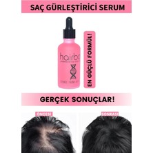 hairbox Kadın Saç Çıkarıcı Serum, Saç Çıkaran Serum , Saç Gürleştirici , Saç Bakım Yağı ( 1 Adet )