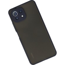 Denza Case Xiaomi Mi 11 Lite Kılıf Kenarları Renkli Mat Kapak - Lacivert