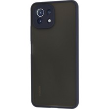 Denza Case Xiaomi Mi 11 Lite Kılıf Kenarları Renkli Mat Kapak - Lacivert