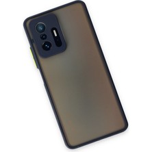 Denza Case Xiaomi Mi 11T Pro Kılıf Kenarları Renkli Mat Kapak - Lacivert