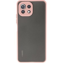 Denza Case Xiaomi Mi 11 Lite Kılıf Kenarları Renkli Mat Kapak - Pembe