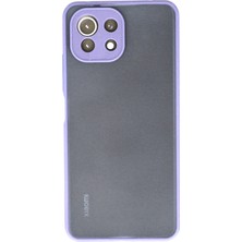 Denza Case Xiaomi Mi 11 Lite Kılıf Kenarları Renkli Mat Kapak - Mor