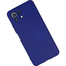 Denza Case Xiaomi Mi 11 Lite Kılıf Içi Kadife Lansman Kapak - Koyu Mor