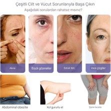 Sfalci Yüz Germe Makinesi Ems  Ultrason Yüz Masajı Cilt Gençlestirici Makinesi Yüz Masaji