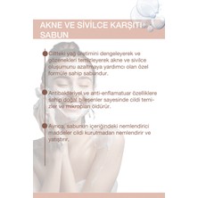 Thiny Beauty Akne ve Sivilce Karşıtı Sabun