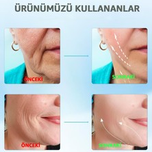 Robeve Yüz ve Boyun Masaj Aleti Ems Cihazı (Gıdı,sarkma,kırşıklık) Güzellik Cihazı 3 Programlı Yüz Masaj Aleti Sıkılaştırıcı Masaj Aleti Kırşıklık Giderici Masaj Aleti Isıtmalı Masaj Titreşimli Masaj Aleti