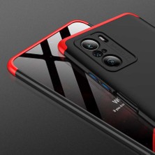 Kilifone - Xiaomi Mi 11i - Kılıf 3 Parçalı Parmak Izi Yapmayan Sert Ays Kapak