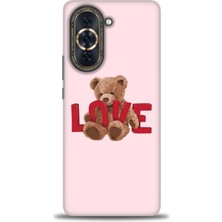 Huawei Nova 10 Kılıf Hd Baskılı - Love Bear + 9h Nano Ekran Koruyucu