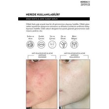 Akne ve Siyah Nokta Oluşumunu Engelleyici Serum 50 Ml... Anti_blackheads Acne Ampoule