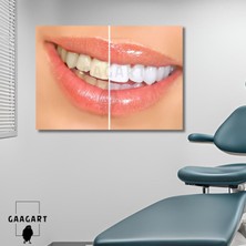 Gaagart Tekli Yatay Kanvas Diş Sağlığı Poliklinik Tablo Dekoratif Diş