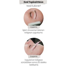 Evol Topical Clove Topikal Krem Epilasyon Dövme Prp 5 x 10 ml