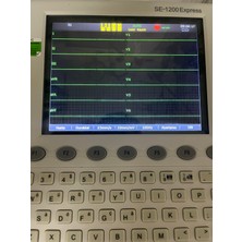 Edan Ekg Cihazı