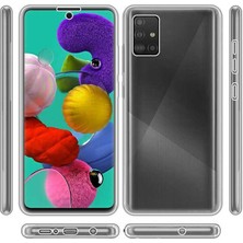 ZORE Galaxy A71 Kılıf Zore Enjoy Kapak-Renksiz