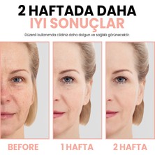 Leke Karşıtı ve Cilt Aydınlatıcı Anti-Blemish Bakım Serumu(Vitamin C Aha-Bha -Alpha-Arbutin Retinol)