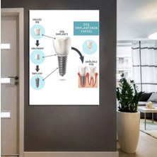 Limitless Design Ağız ve Diş Sağlığı Polikliniği Tabloları Dekoratif Diş, Dekoratif Dişçi, Dişçi Dekorasyonu Dsc-58
