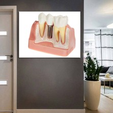 Limitless Design Ağız ve Diş Sağlığı Polikliniği Tabloları Dekoratif Diş, Dekoratif Dişçi, Dişçi Dekorasyonu