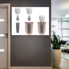 Limitless Design Ağız ve Diş Sağlığı Polikliniği Tabloları Dekoratif Diş, Dekoratif Dişçi, Dişçi Dekorasyonu