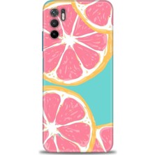 Kılıf Evreni Xiaomi Poco M3 Pro Kılıf Hd Baskılı Kılıf - Pembe Limon + 9h Nano Ekran Koruyucu