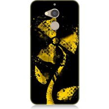 Teknomeg General Mobile Gm8 Uyumlu Rüzgar Gülü  Desenli Silikon Kılıf