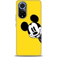 Huawei Nova 9 Kılıf Hd Baskılı - Sarı Mickey Mouse + 9h Nano Ekran Koruyucu