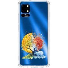 Zeyno Reeder S19 Max Uyumlu Renkli Ağaç Desenli Silikon Kılıf