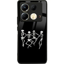 S-Case Infinix Note 40 Dancer Skeleton Tasarımlı Glossy Telefon Kılıfı