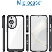 Microcase Huawei Nova 12S / Nova 11 Shield Serisi Darbeye Dayanıklı Yarı Esnek Plastik Tpu Kılıf - AL8100