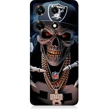 Teknomeg Infinix Note 30 Pro Uyumlu Karanlık Korsan  Desenli Silikon Kılıf
