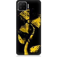 Oppo A73 Uyumlu Rüzgar Gülü  Desenli Silikon Kılıf