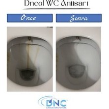 DNC Wc Lavabo Temizleyici Sarı Leke Giderici -Ol Wc Antisarı