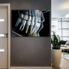 Tosbart Ağız Ve Diş Sağlığı Polikliniği Tabloları Dekoratif Diş, Dsc-35