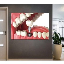 Tosbart Ağız Ve Diş Sağlığı Polikliniği Tabloları Dekoratif Diş, Dsc-156