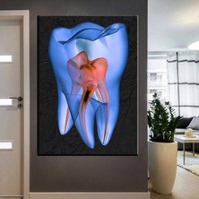 Tosbart Ağız Ve Diş Sağlığı Polikliniği Tabloları Dekoratif Diş, Dsc-135