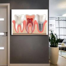 Tosbart Ağız Ve Diş Sağlığı Polikliniği Tabloları Dekoratif Diş,