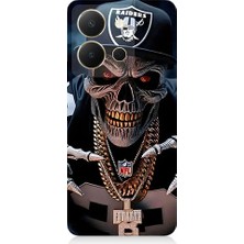 Teknomeg Vivo Y36 Uyumlu Karanlık Korsan  Desenli Silikon Kılıf