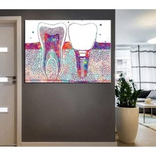 TosbArt Ağız ve Diş Sağlığı Polikliniği Tabloarı Dekoratif Dişçi Dekorasyonu Dsc-07