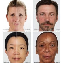 iderma Onarıcı, Yaşlanma Karşıtı ve Gençleştirici LED Maske