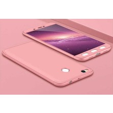 Mobify Redmi 4x Kılıf 3 Parçalı Şık Patch Sert Silikon Kapak