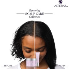 Alterna Scalp Care Yenileyici Saç Derisi Bakımı 177ML