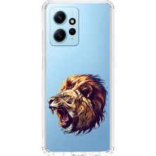Zeyno Xiaomi Redmi Note 12 4g Uyumlu Xxxxxxxx  Desenli Silikon Kılıf