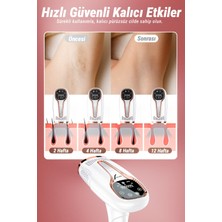 VeryFit Ipl Buz Lazer Epilasyon 999.999 Atım Otomatik / Manuel Dokunmatik Ekran Ağrısız Epilatör