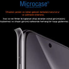 Microcase Iphone 16 Pro ile Uyumlu Tpu Arka ve Yan Nano Koruma- EKM115