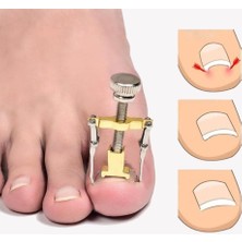 Batık Tırnak Düzeltme Aleti